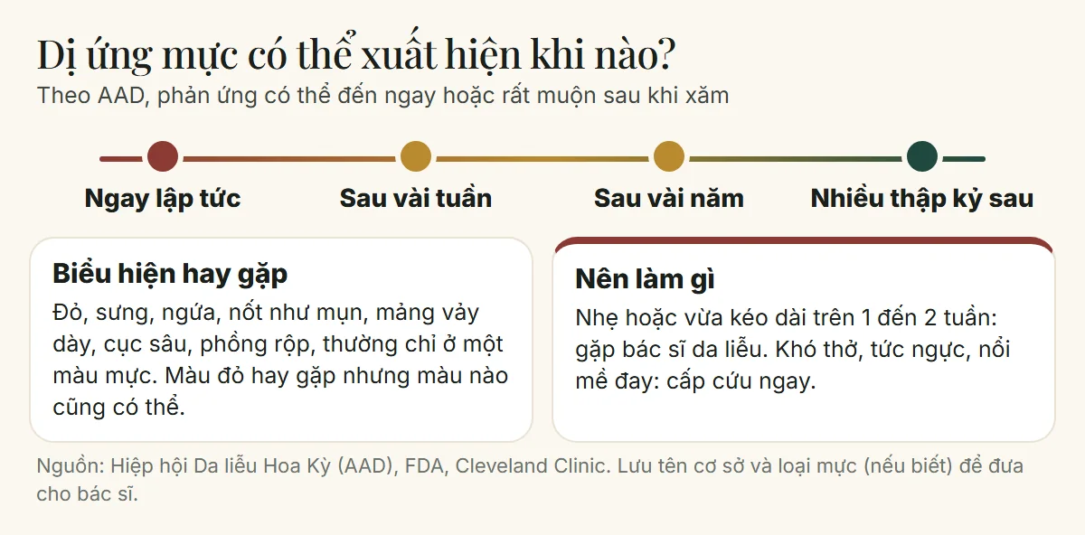 Dị ứng mực xăm có thể xuất hiện ngay, sau vài tuần, vài năm hoặc nhiều thập kỷ, kèm biểu hiện hay gặp và cách xử lý theo AAD